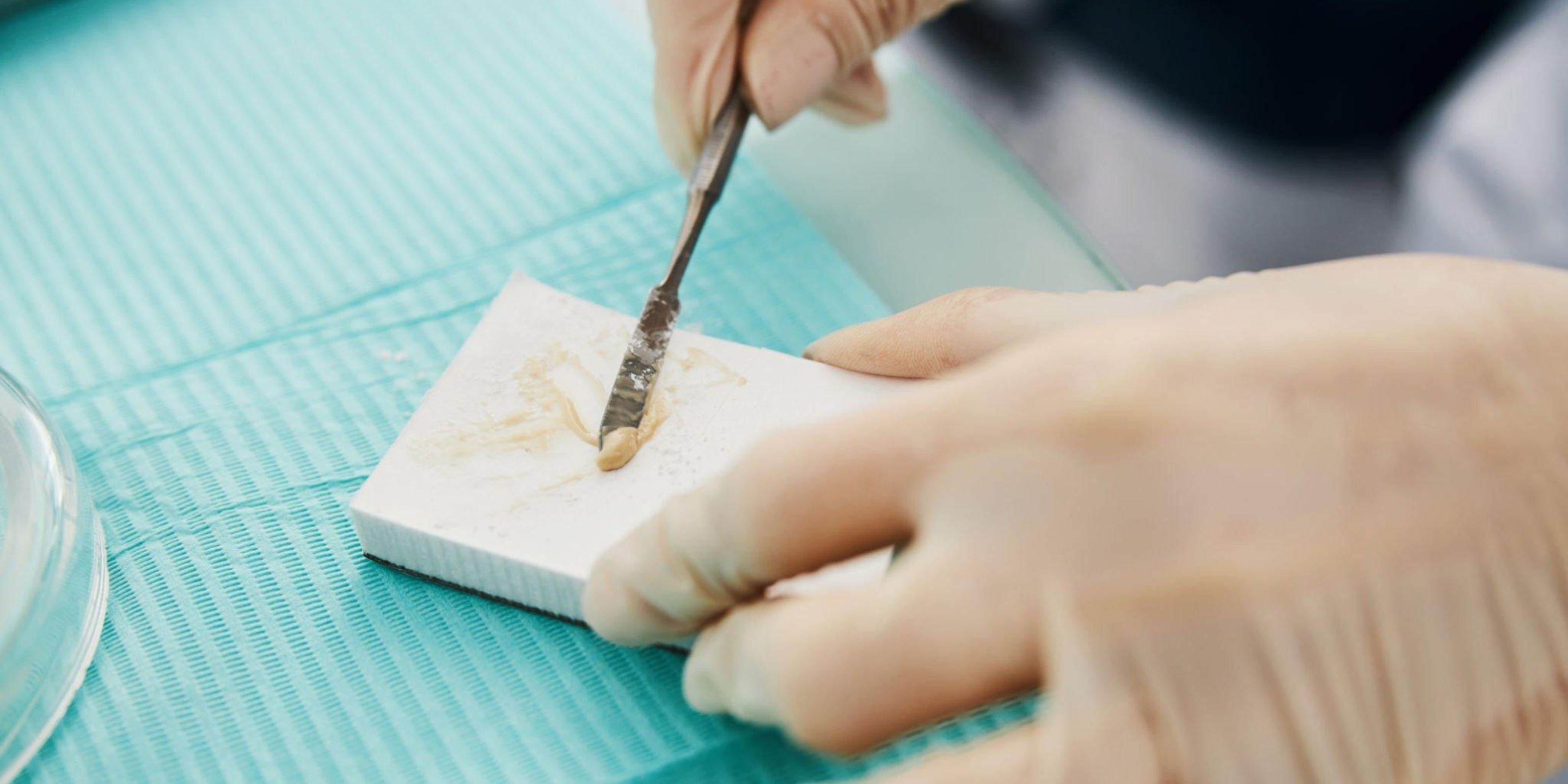 How Strong is Dental Cement? - Dental Cement