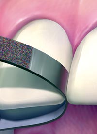 NTI Diamond Strips 2.5 mm MEDIUM - Single-Sided (Pack of 10 Strips)