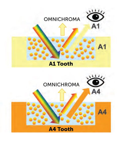 Tokuyama Omnichroma Universal Shade Composite - 4g Syringe: A Breakthrough in Aesthetic Dentistry