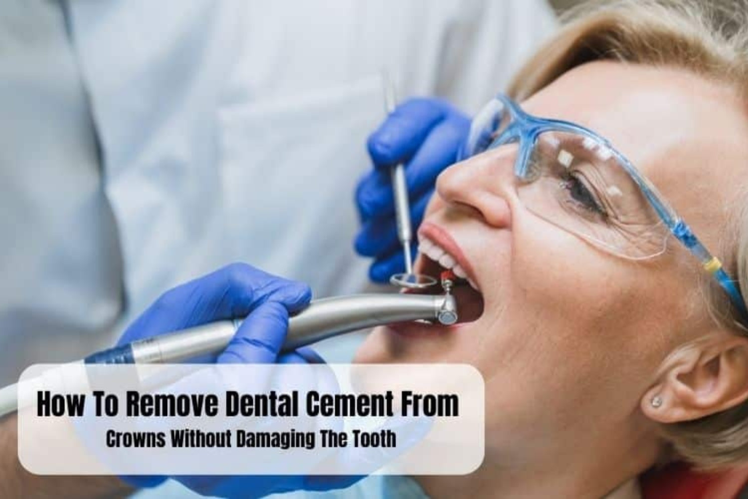 How To Remove Dental Cement From Crown?