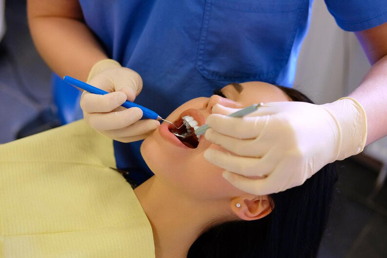 Filling, Inlay, Onlay, or Dental Crown? What is the Difference?
